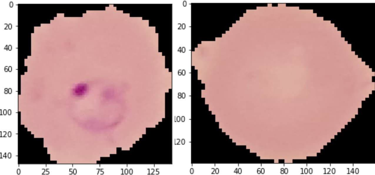 Deep Learning for Malaria Detection from Blood Smears